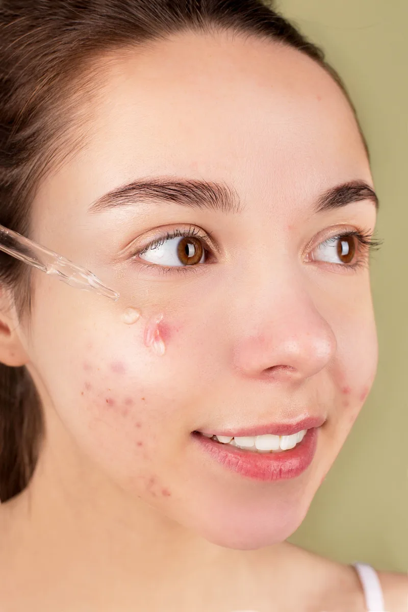 Close-up of a woman applying vitamin C facial serum as part of her morning skincare routine